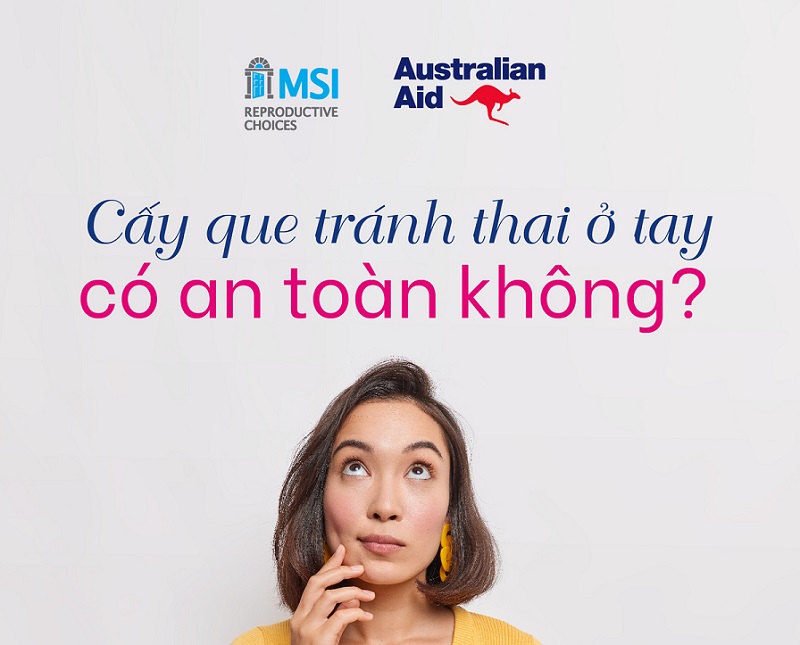 cấy que tránh thai an toàn không